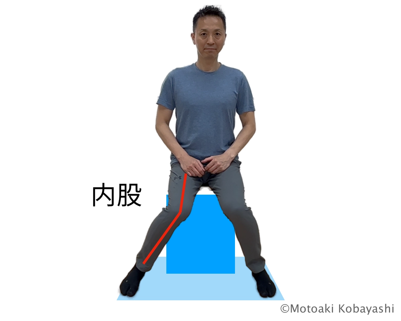 鵞足炎になりやすい人１